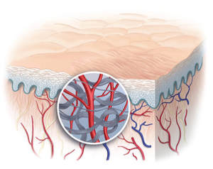 wound-healing